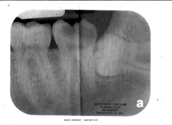 Ouch! My TEEF HURT! Ouch! My TEEF HURT!