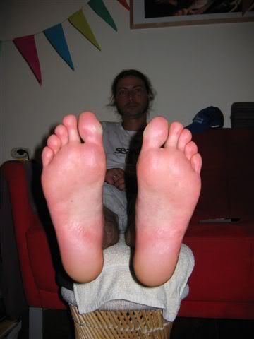 Feet with small blister